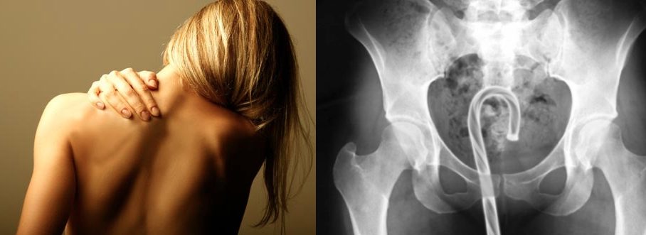 10 des « accidents » sexuels les plus gênants! -2