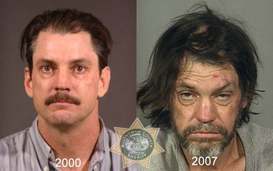 Meth : 20 images avant/après montrant les terribles dommages que fait cette drogue au corps