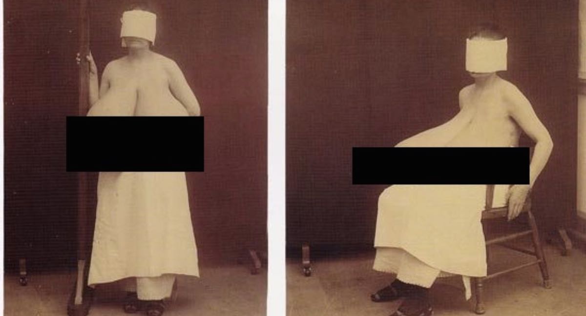 Les 10 images médicales historiques les plus perturbantes jamais vues