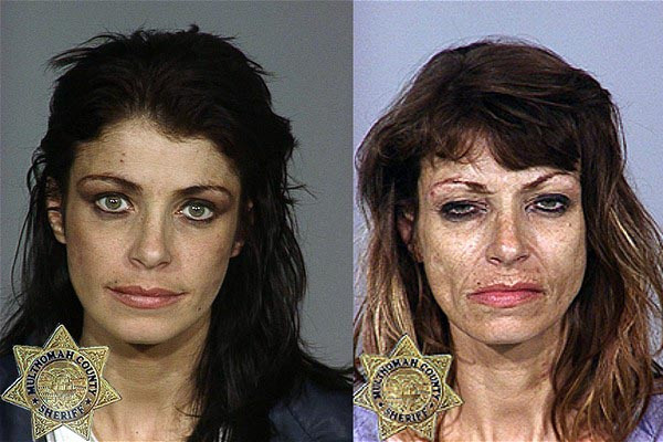 17 photos avant/après qui montrent les ravages de la drogue dure
