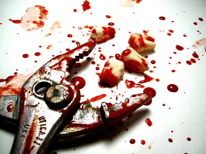 Dossier criminel insolite: l’obsédé des grosses femmes sans dents!