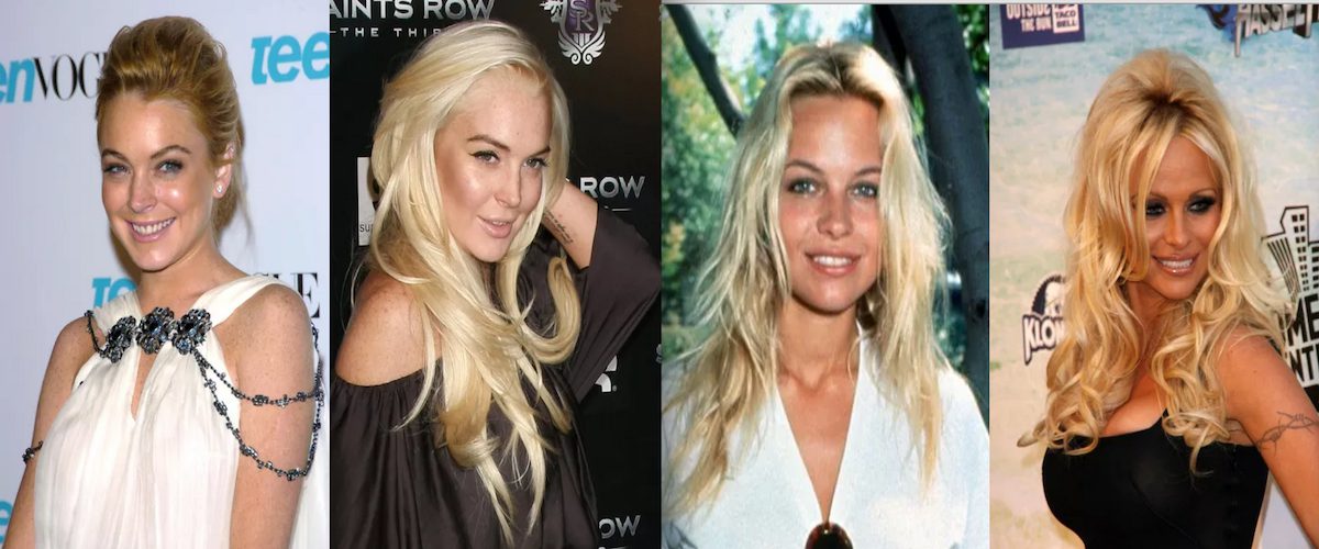 12 célébrités qui étaient bien plus belles avant la chirurgie