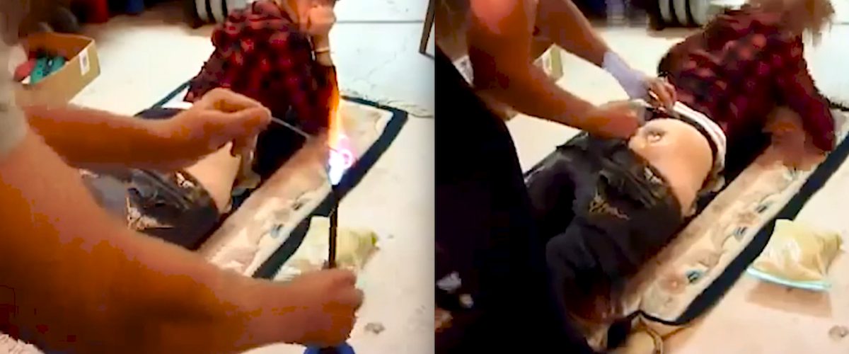 QUOI? Un gars brûle les fesses de sa blonde en guise de «cadeau»!